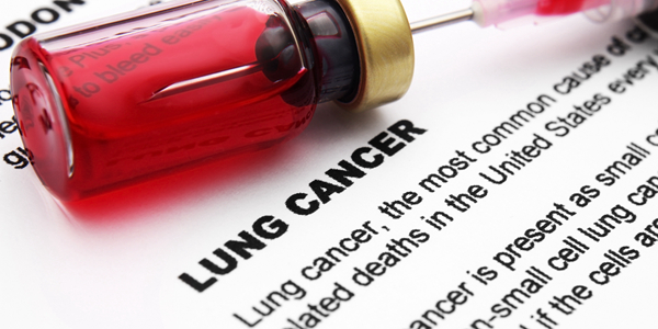 阿斯利康治疗非小细胞肺癌药物获FDA批准