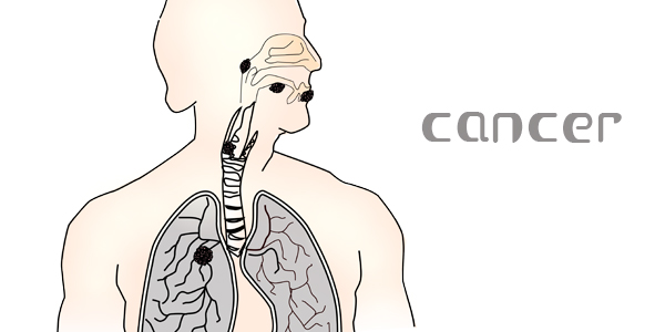 肺癌转移症状及应对方法