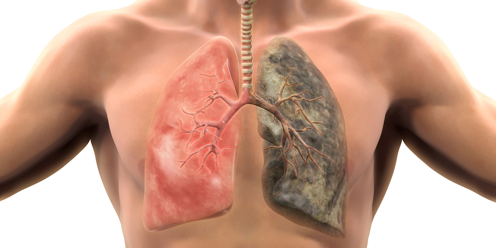 肺癌的早期症状