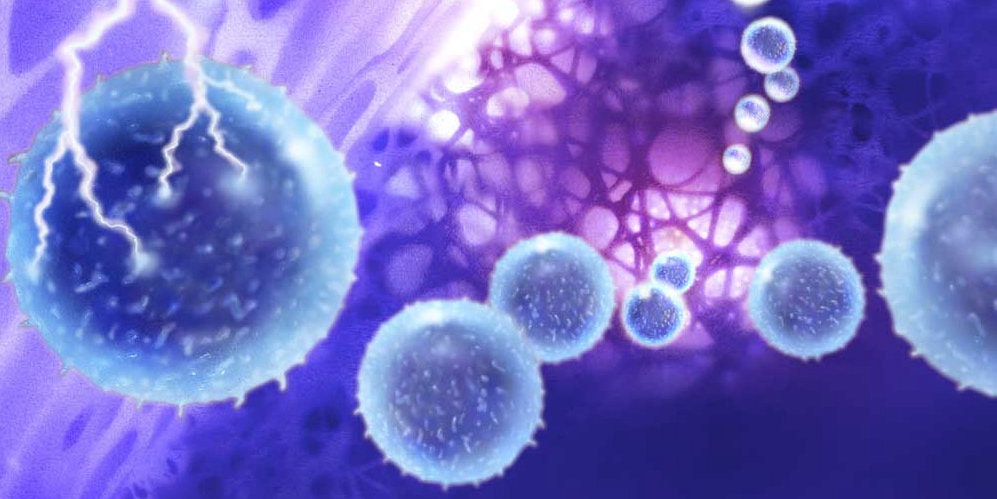 免疫疗法在非霍奇金淋巴瘤治疗方面取得重大进展
