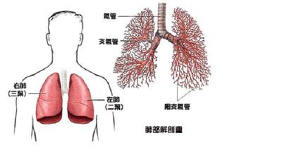 肺癌的种类有哪些