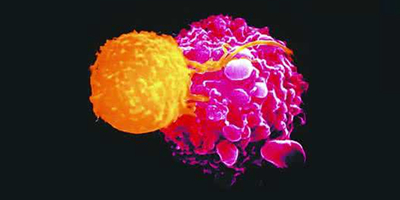 武田公布新药ADCETRIS治疗T细胞淋巴瘤的临床试验结果