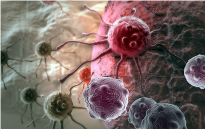 Biotecnol新药有望对多种类型的肿瘤均有效