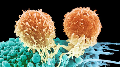 新研发的基因疗法有望用于治疗侵袭性淋巴瘤