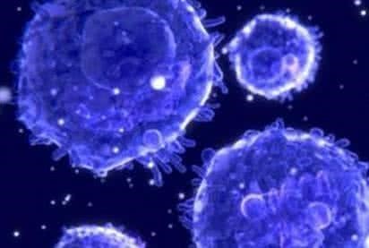 有证据表明，肿瘤细胞老化或许能有效治疗弥漫性大B细胞淋巴瘤