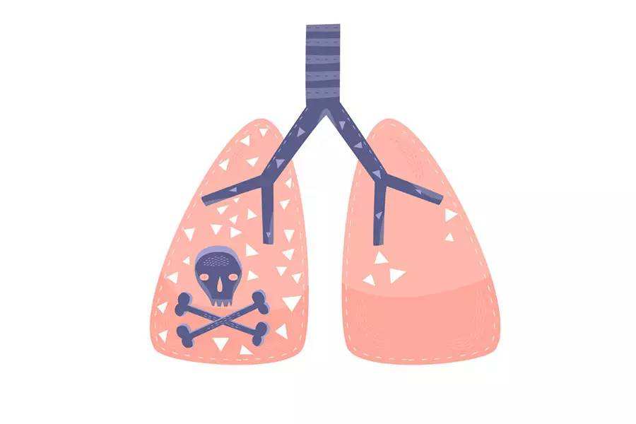 奈非必利治疗晚期肺癌患者的五年生存率高于历史率