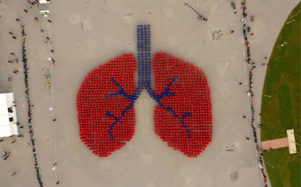 人类肺上芯片技术用于研究其自然环境中的肺癌的行为和药物反应