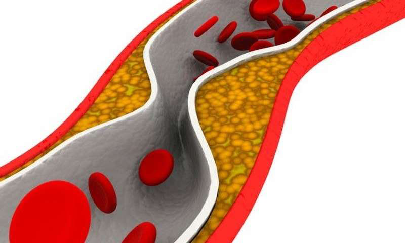 研究表明，类风湿性关节炎增加了血栓的可能性