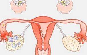 FDA在用于去除子宫肌瘤的设备上增加了“盒装警告”