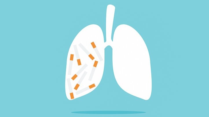 戒烟后你的身体状况和肺癌风险会发生几点变化
