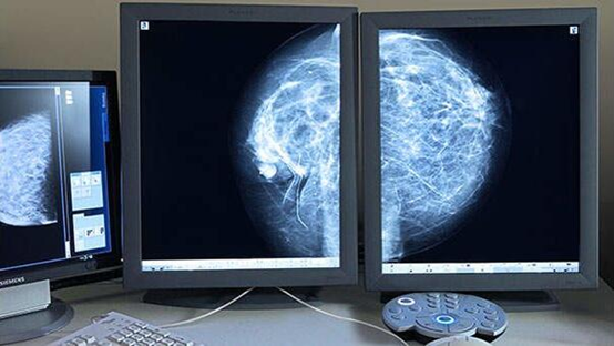 早期乳腺癌并非“急症”