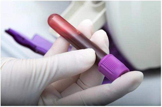 血液检查可使肺癌患者更早获得个性化治疗