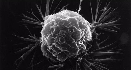 PD-1在肿瘤特异性T细胞上的表达：免疫治疗的朋友还是敌人？