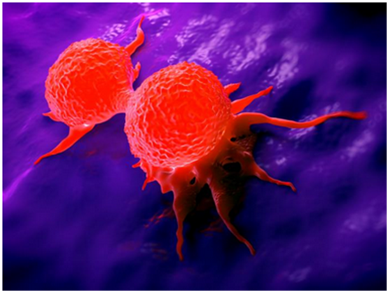 乳腺癌化疗后免疫系统需要很长时间才能恢复