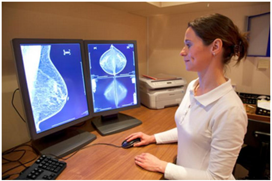 与未来乳腺癌风险相关的免疫细胞组成改变