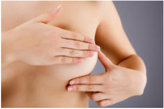 双侧乳房切除术并不能降低单侧乳腺癌的死亡率